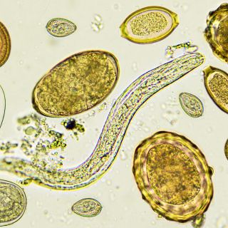 Mélytisztítás a paraziták ellen